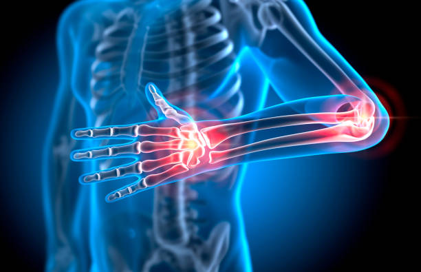 Muskeln, Knochen & Gelenke